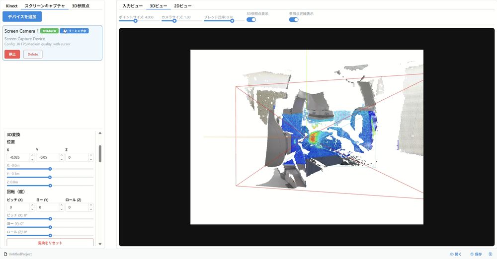 心臓血管撮影における散乱線源の3Dイメージング