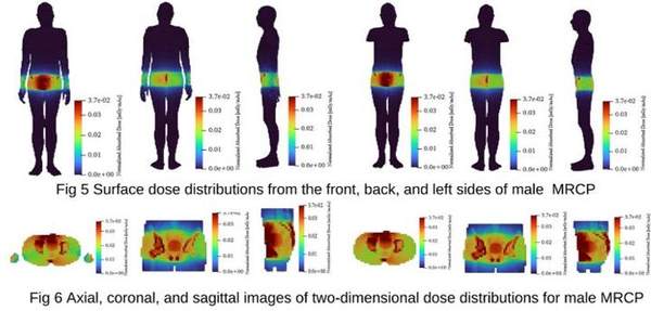 Organ dose distribution on a computational phantom