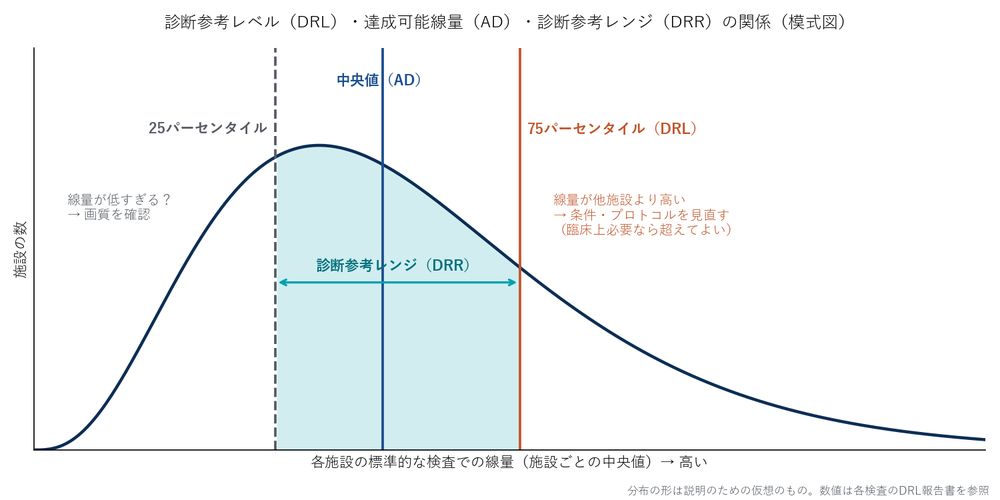 施設ごとの線量の分布に、25パーセンタイル・中央値（AD）・75パーセンタイル（DRL）の線を引いた模式図