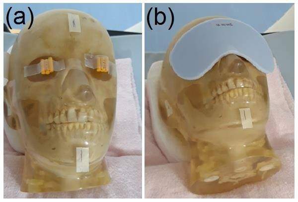 Lens dose reduction by a silicone radiation-protective material